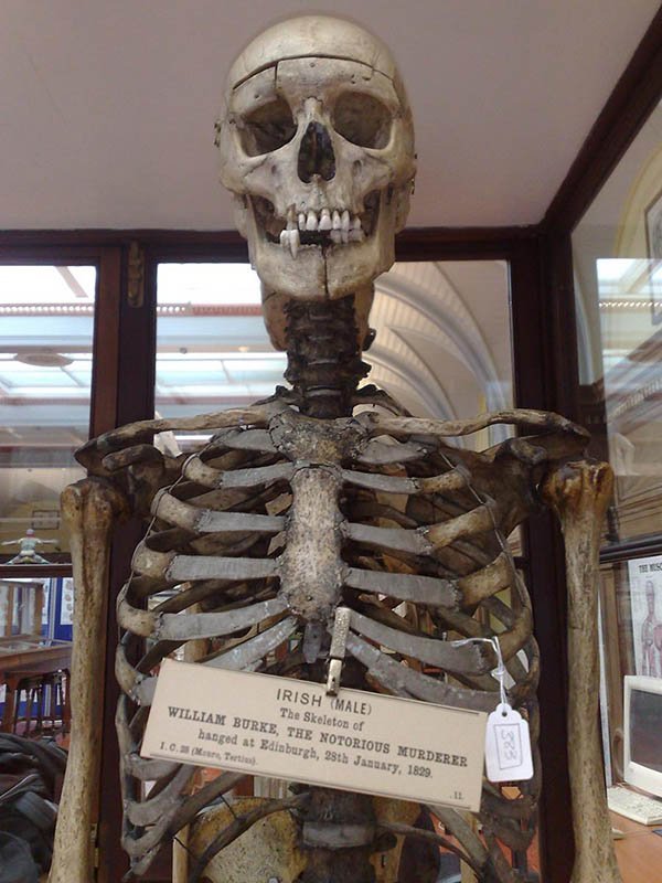 esqueleto william burke serial killer escocia